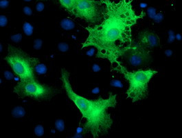 ERBB2 Antibody in Immunocytochemistry (ICC/IF)