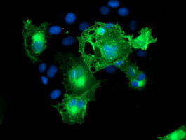 ERBB2 Antibody in Immunocytochemistry (ICC/IF)