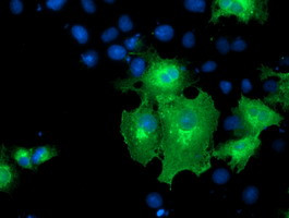 ERBB2 Antibody in Immunocytochemistry (ICC/IF)