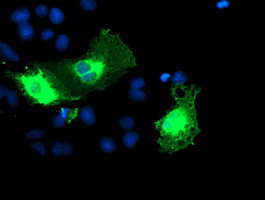 ERBB2 Antibody in Immunocytochemistry (ICC/IF)