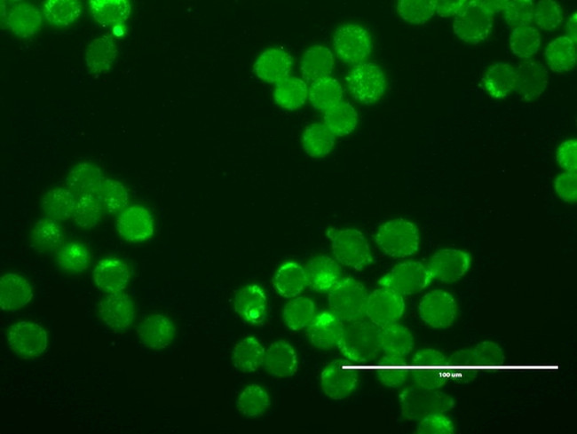 ERBB2 Antibody in Immunocytochemistry (ICC/IF)