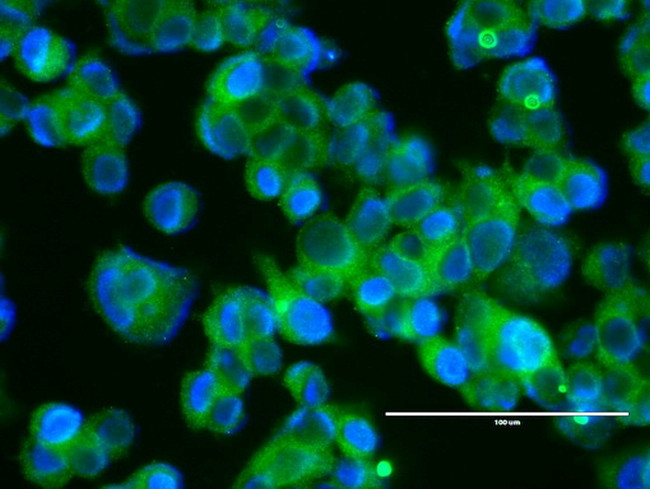 ERBB2 Antibody in Immunocytochemistry (ICC/IF)