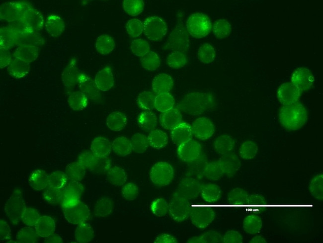 ERBB2 Antibody in Immunocytochemistry (ICC/IF)