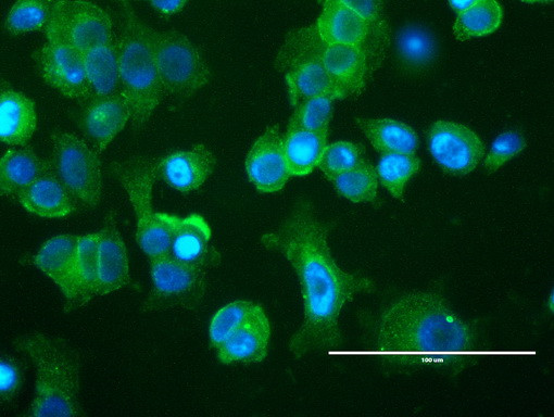 ERBB2 Antibody in Immunocytochemistry (ICC/IF)