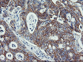 ERBB2 Antibody in Immunohistochemistry (Paraffin) (IHC (P))