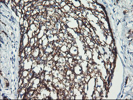 ERBB2 Antibody in Immunohistochemistry (Paraffin) (IHC (P))