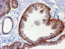 ERBB2 Antibody in Immunohistochemistry (Paraffin) (IHC (P))