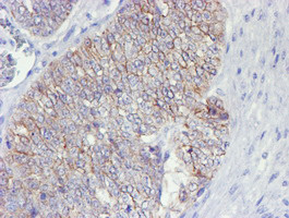 ERBB2 Antibody in Immunohistochemistry (Paraffin) (IHC (P))