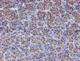 ERBB2 Antibody in Immunohistochemistry (Paraffin) (IHC (P))