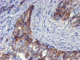 ERBB2 Antibody in Immunohistochemistry (Paraffin) (IHC (P))