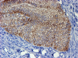 ERBB2 Antibody in Immunohistochemistry (Paraffin) (IHC (P))