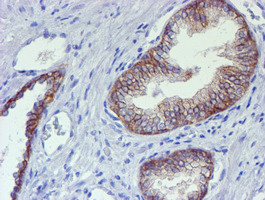 ERBB2 Antibody in Immunohistochemistry (Paraffin) (IHC (P))