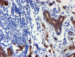 ERBB2 Antibody in Immunohistochemistry (Paraffin) (IHC (P))