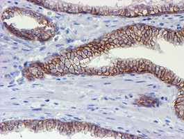 ERBB2 Antibody in Immunohistochemistry (Paraffin) (IHC (P))