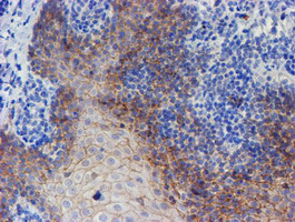 ERBB2 Antibody in Immunohistochemistry (Paraffin) (IHC (P))