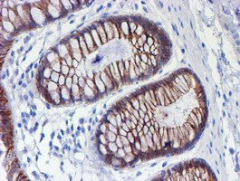 ERBB2 Antibody in Immunohistochemistry (Paraffin) (IHC (P))