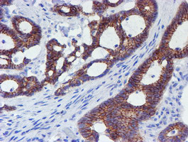 ERBB2 Antibody in Immunohistochemistry (Paraffin) (IHC (P))