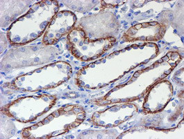 ERBB2 Antibody in Immunohistochemistry (Paraffin) (IHC (P))