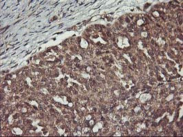 ERBB2 Antibody in Immunohistochemistry (Paraffin) (IHC (P))