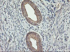 ERBB2 Antibody in Immunohistochemistry (Paraffin) (IHC (P))