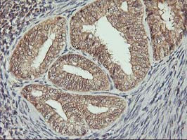 ERBB2 Antibody in Immunohistochemistry (Paraffin) (IHC (P))