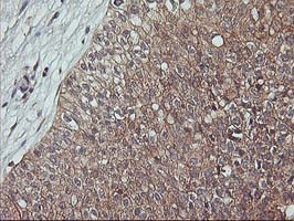 ERBB2 Antibody in Immunohistochemistry (Paraffin) (IHC (P))