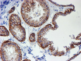 ERBB2 Antibody in Immunohistochemistry (Paraffin) (IHC (P))