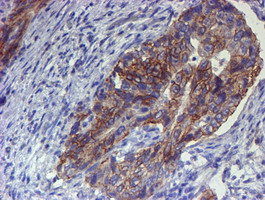 ERBB2 Antibody in Immunohistochemistry (Paraffin) (IHC (P))