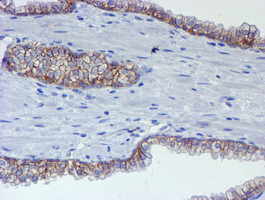 ERBB2 Antibody in Immunohistochemistry (Paraffin) (IHC (P))