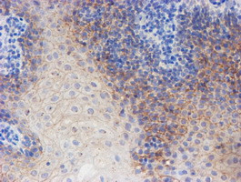 ERBB2 Antibody in Immunohistochemistry (Paraffin) (IHC (P))