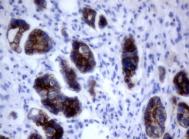 ERBB2 Antibody in Immunohistochemistry (Paraffin) (IHC (P))