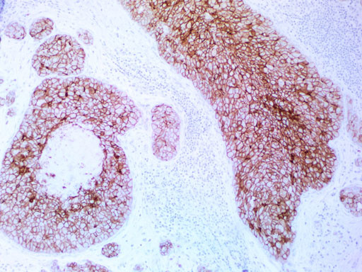 ERBB2 Antibody in Immunohistochemistry (Paraffin) (IHC (P))