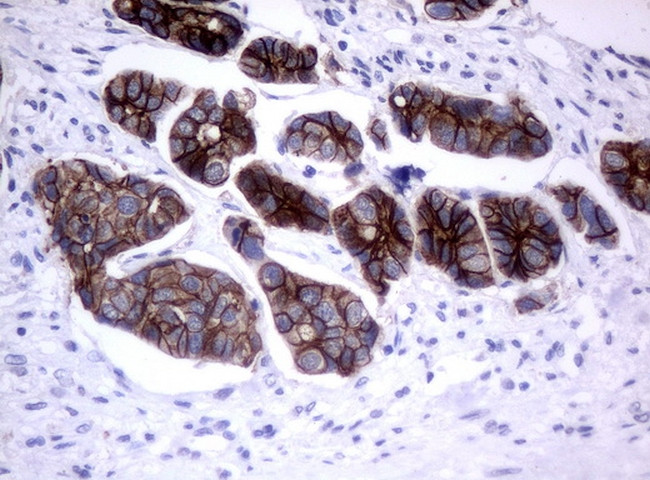 ERBB2 Antibody in Immunohistochemistry (Paraffin) (IHC (P))