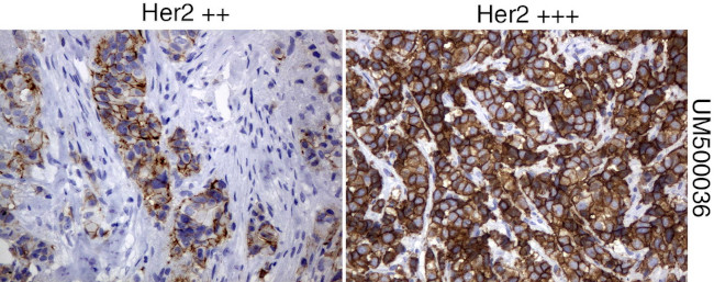 ERBB2 Antibody in Immunohistochemistry (Paraffin) (IHC (P))