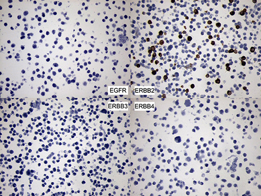 ERBB2 Antibody in Immunocytochemistry (ICC/IF)