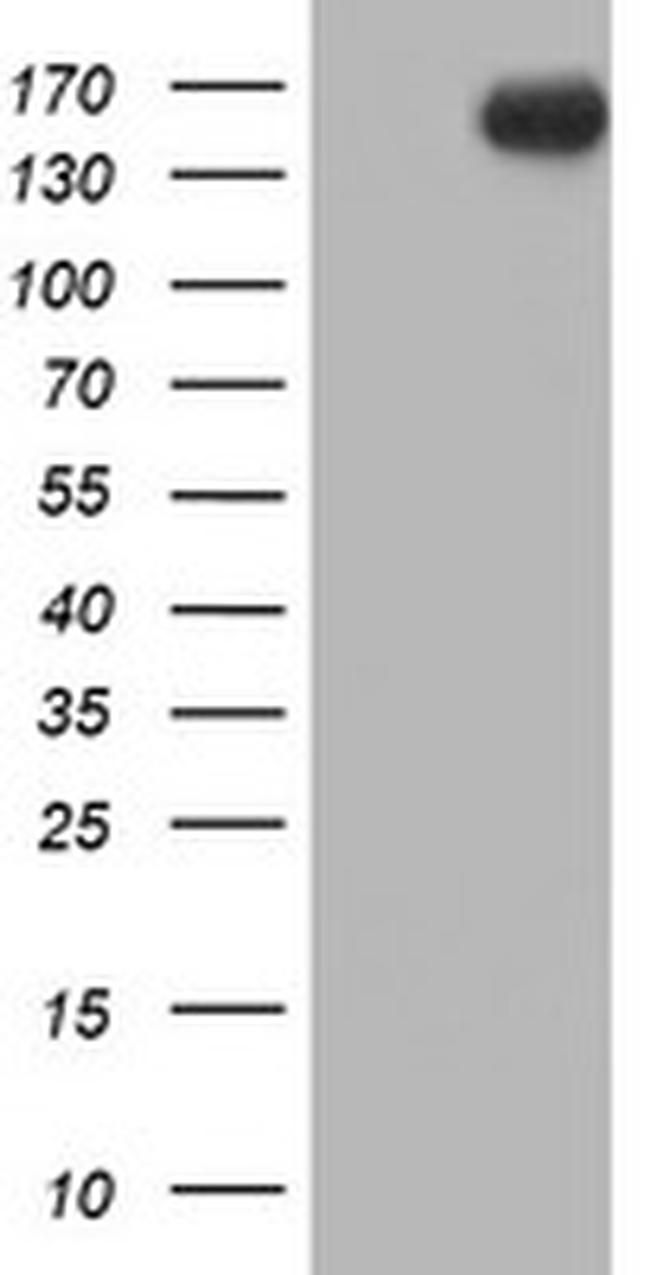 ERBB2 Antibody in Western Blot (WB)