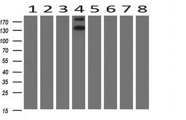 ERBB2 Antibody in Western Blot (WB)