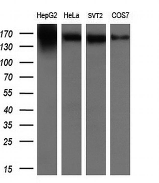 ERBB2 Antibody in Western Blot (WB)