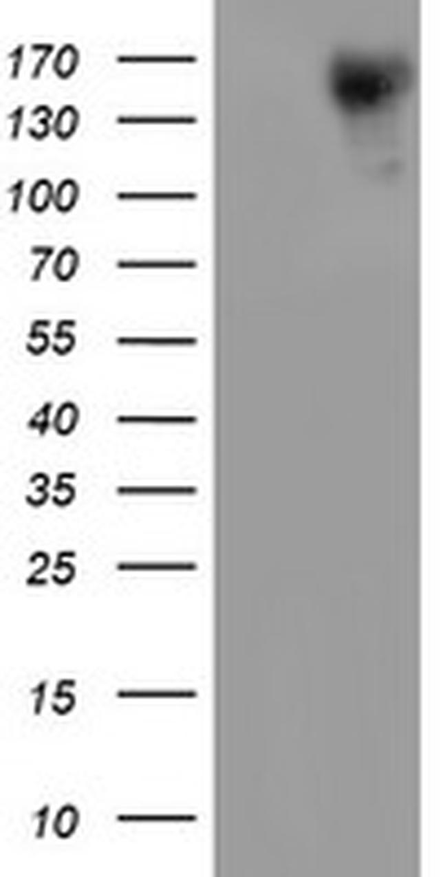 ERBB2 Antibody in Western Blot (WB)