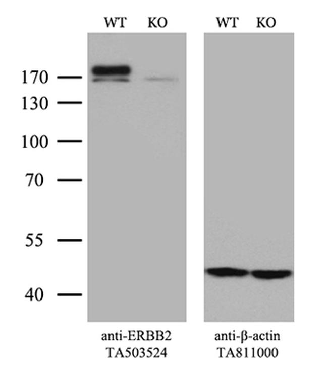 ERBB2 Antibody in Western Blot (WB)