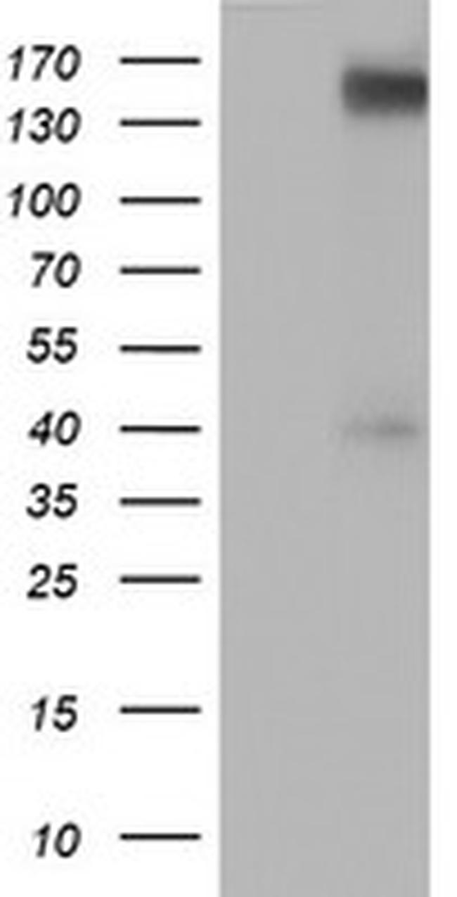 ERBB2 Antibody in Western Blot (WB)