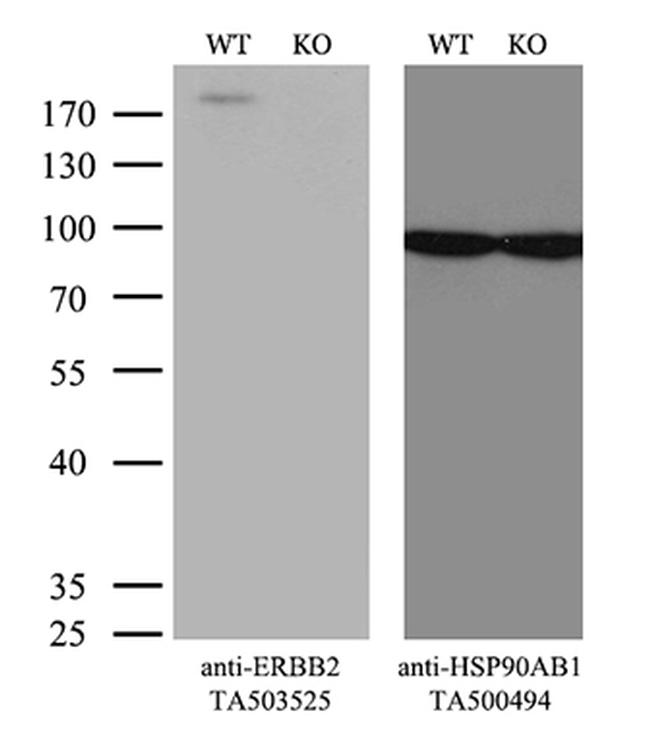 ERBB2 Antibody in Western Blot (WB)