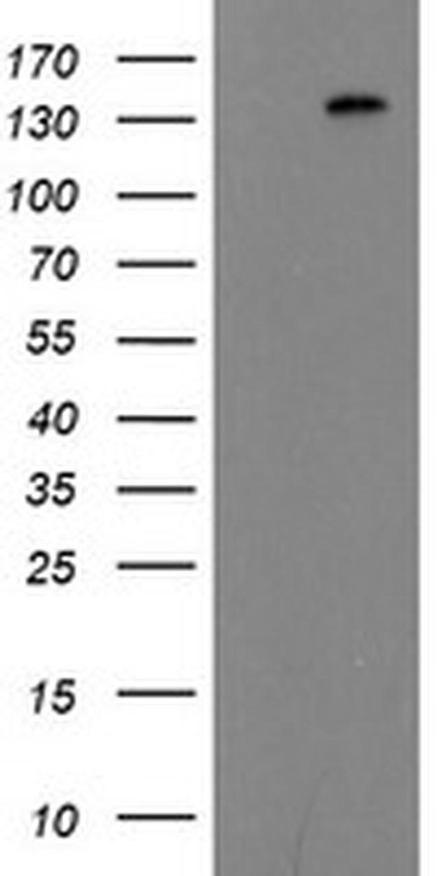 ERBB2 Antibody in Western Blot (WB)