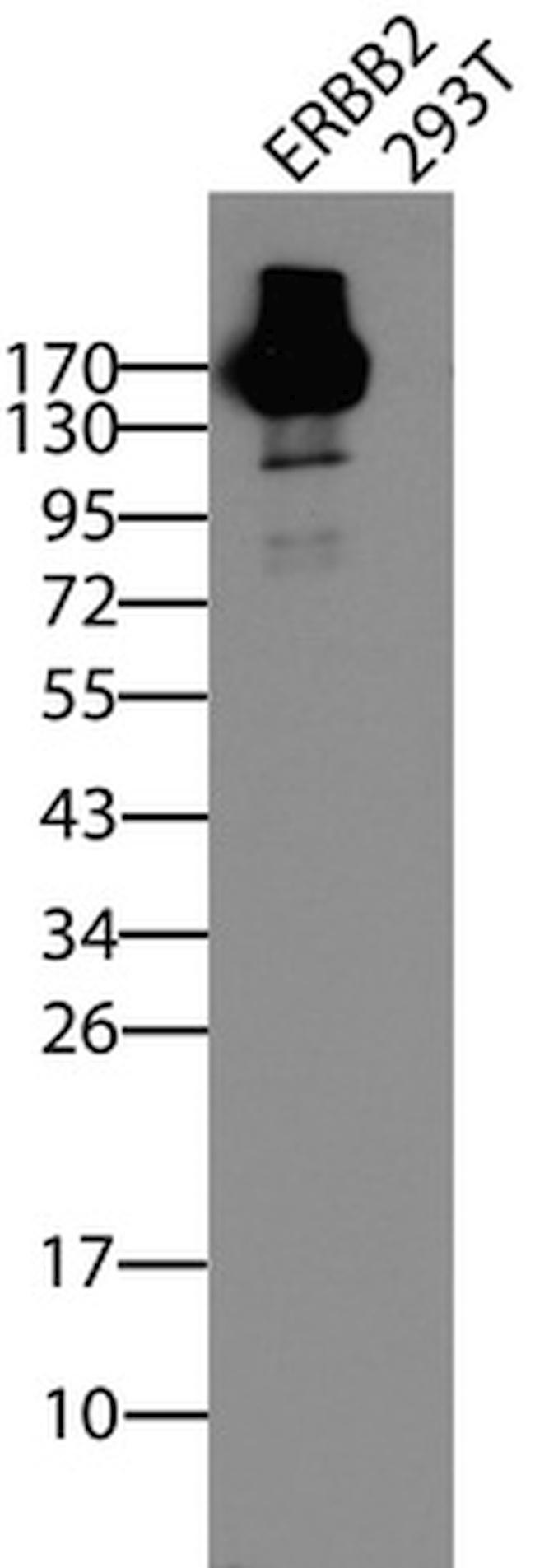 ERBB2 Antibody in Western Blot (WB)