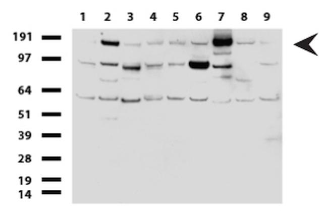 ERBB2 Antibody in Western Blot (WB)