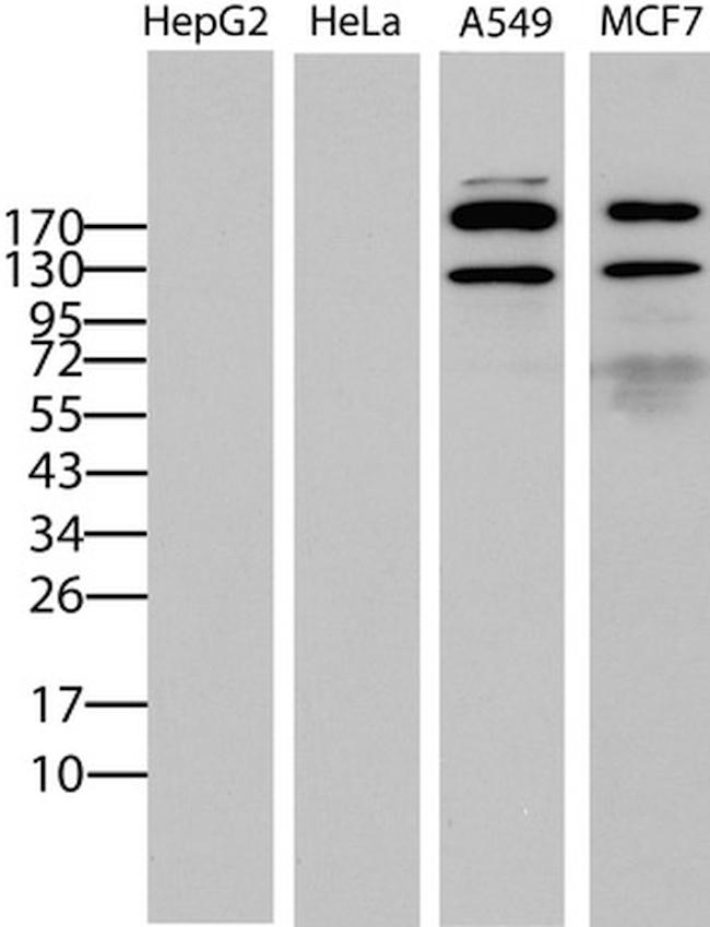 ERBB2 Antibody in Western Blot (WB)