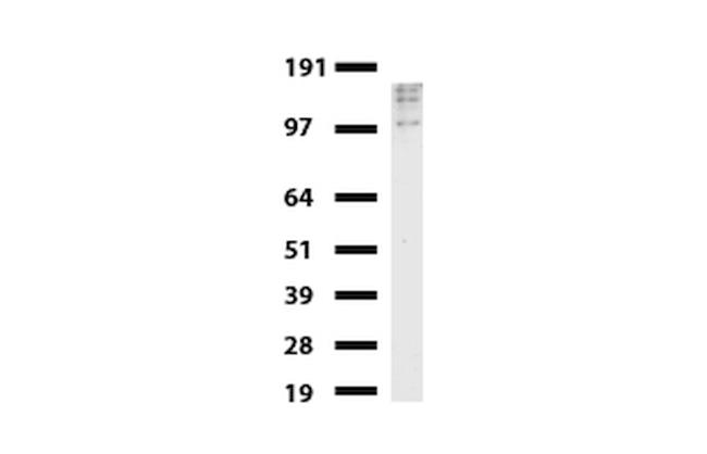 ERBB2 Antibody in Western Blot (WB)