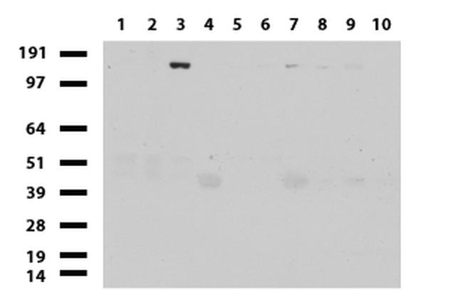 ERBB2 Antibody in Western Blot (WB)