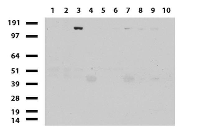 ERBB2 Antibody in Western Blot (WB)