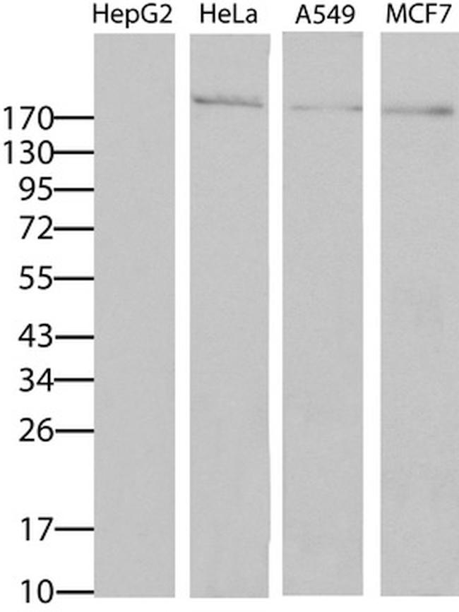 ERBB2 Antibody in Western Blot (WB)